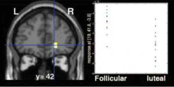 Brain's Reward Circuit Activity Ebbs And Flows With A Woman's Hormonal Cycle
