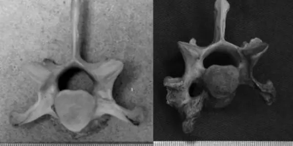 Bone deformities linked to inbreeding in Isle Royale wolves