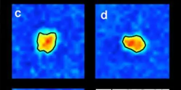 How the retina works: Like a multi-layered jigsaw puzzle of receptive fields