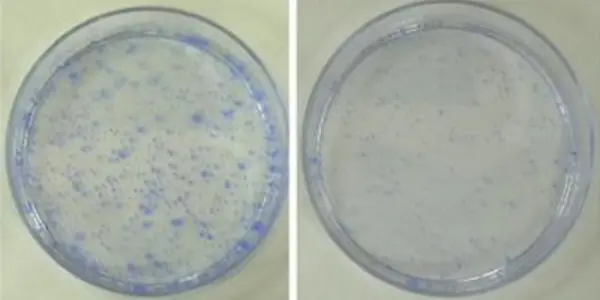 SIRT1, The 'Longevity' Protein, May Inhibit Cancer Too