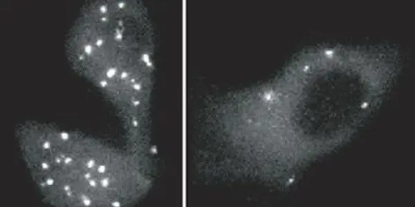 When cancer cells can't let go