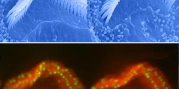 Cadherin, Protocadherin And Finding Hearing's 'Holy Grail'