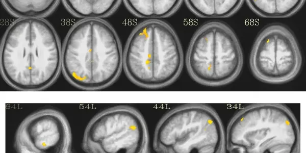 This Is Your Brain On Zen - Experienced Meditators Recover More Quickly