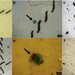 Epidemiology: Microplastics Cause Lung Cancer